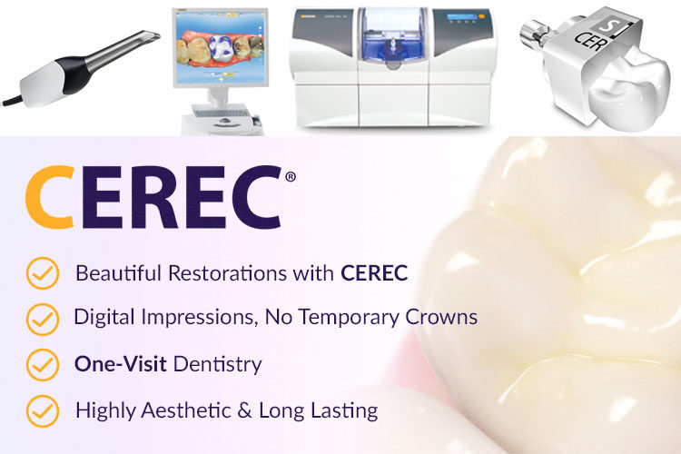 CEREC Same Day Dental Restoration